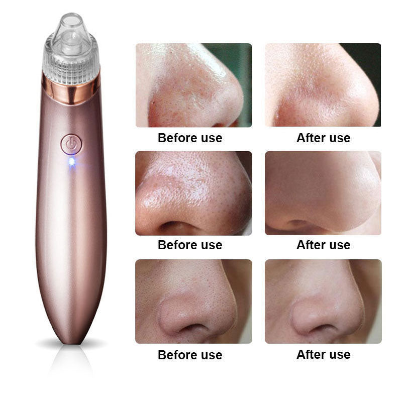 Blackhead Remover Face Acne Black Dot Pimple Electric Blackhead Vacuum Cleaner Pore Skin Care Tools Machine 4 Replacement Head